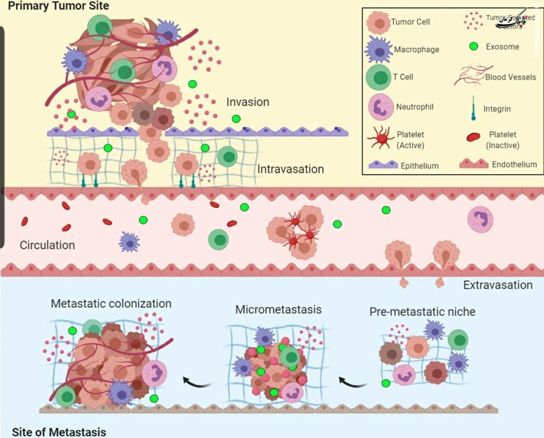بیش از ۹۰ درصد موارد مرگ و میر در سرطان ها در اثر متاستاز است